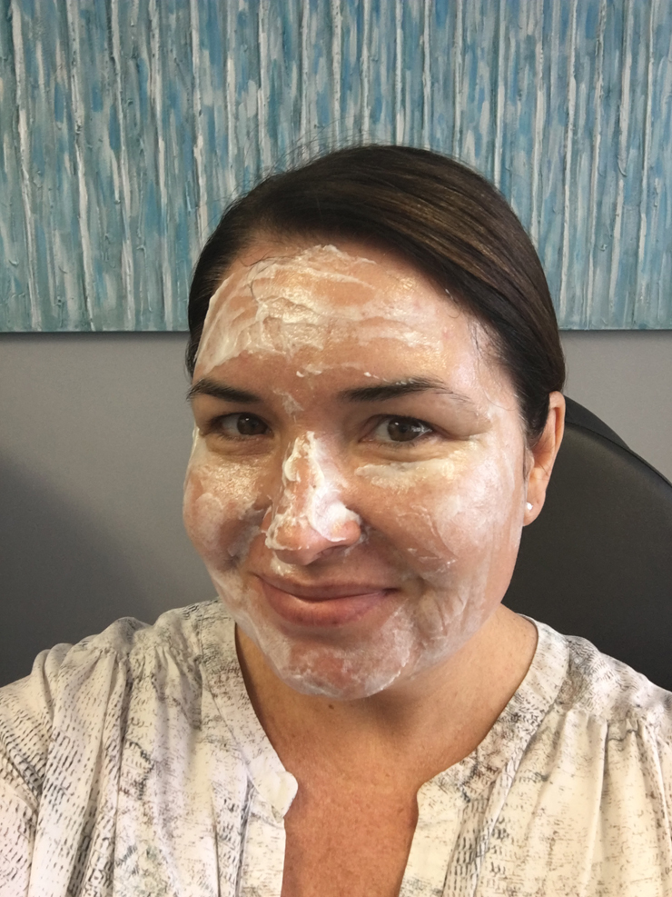 Los Angeles HALO patient with numbing cream on her face