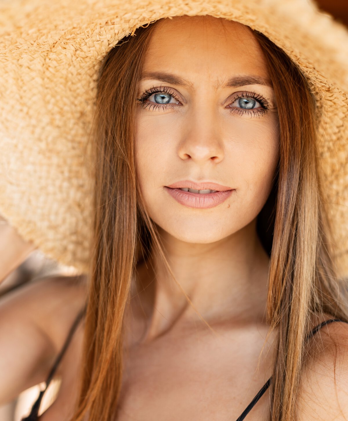 Los Angeles Dermal fillers patient smiling