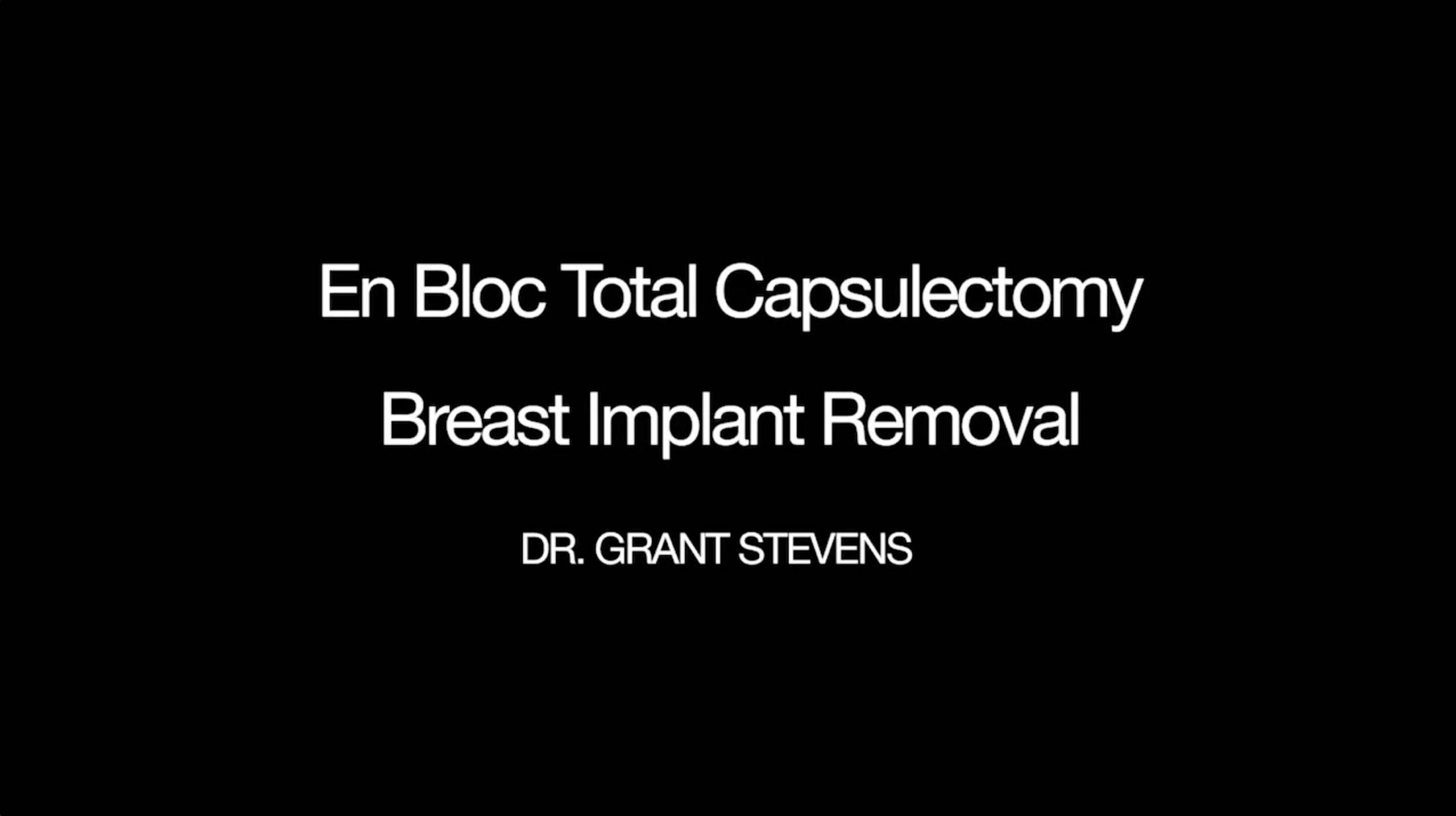 Breast Implant Removal Los Angeles Marina Plastic Surgery image