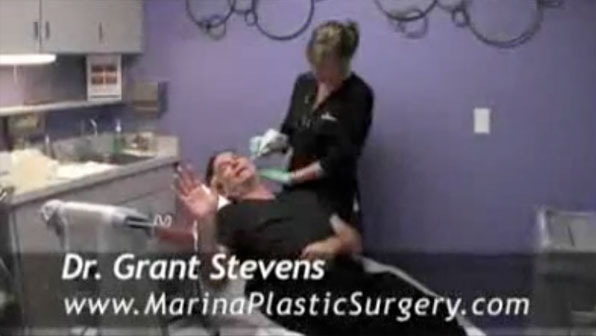 Marina Plastic Surgery Los Angeles exilis facelift video