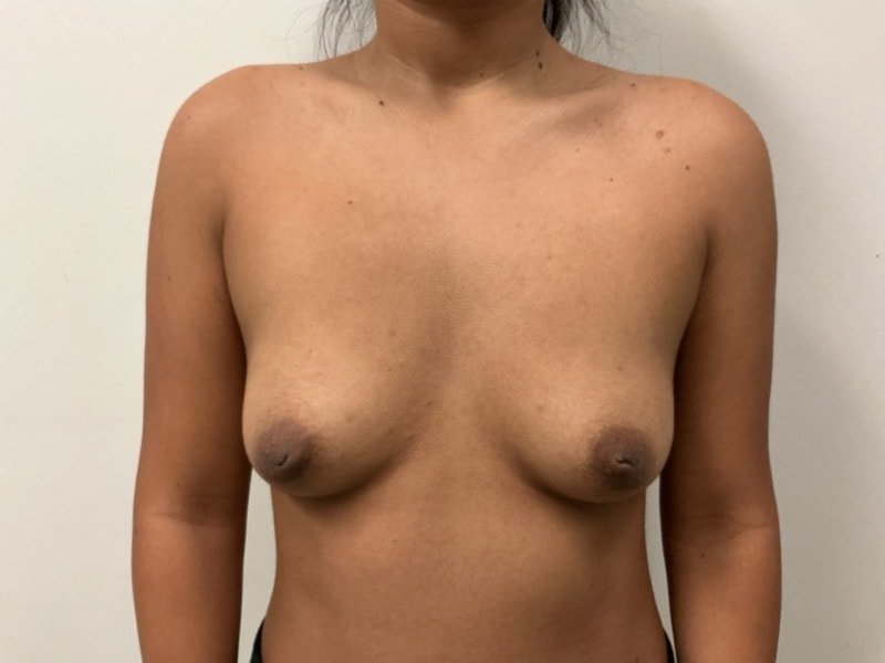  Before & After Image