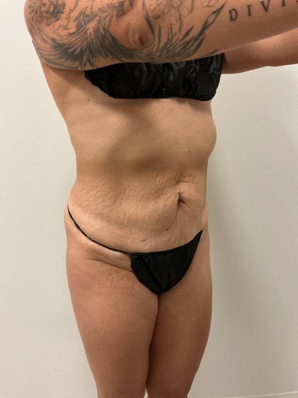  Before & After Image